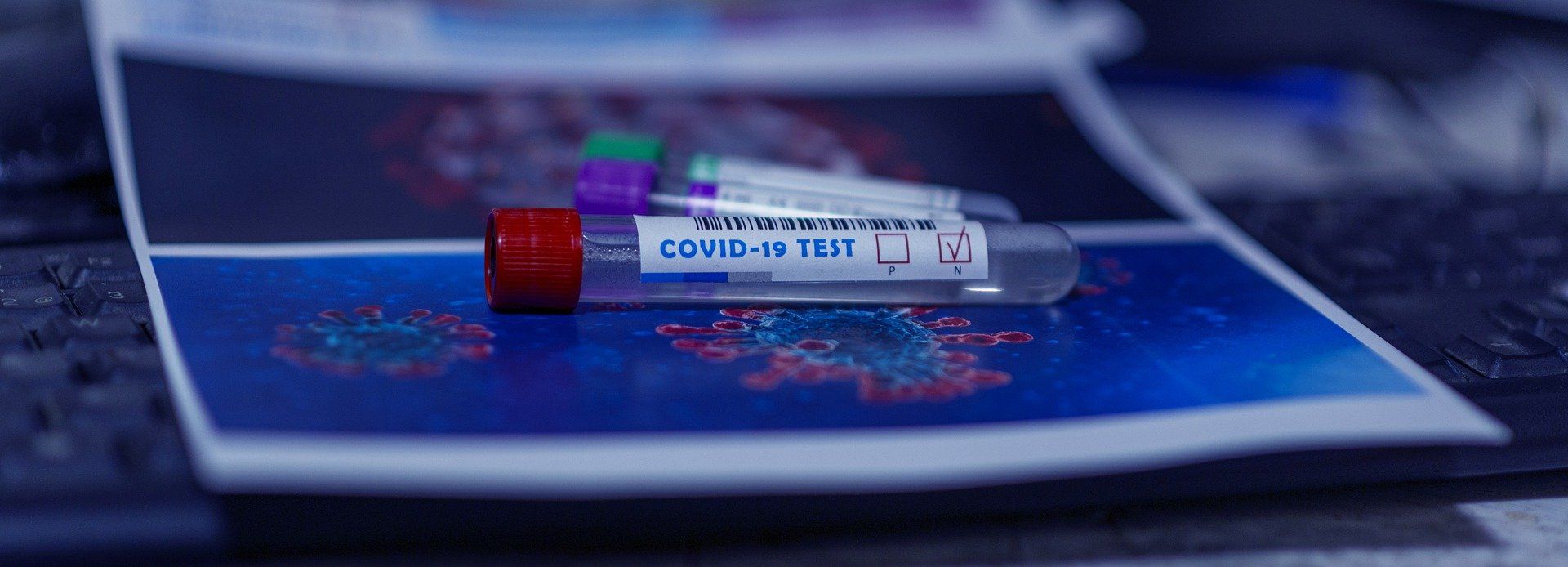 В Архангельской области еще 79 человек заразились коронавирусом