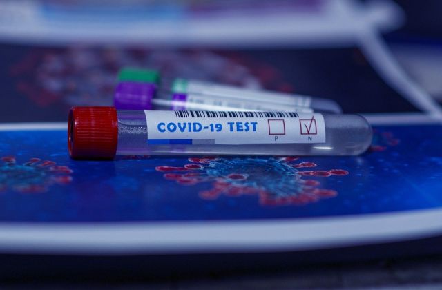 В Архангельской области еще 79 человек заразились коронавирусом